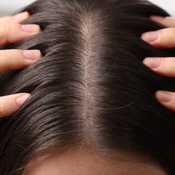 Especialistas en Tratamientos anticaída