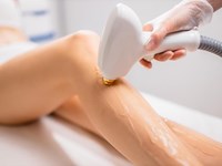 Ventajas de la depilación láser frente a otros métodos